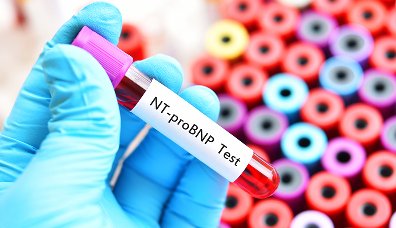 NT-ProBNP【N端脑钠肽前体单克隆抗体】说明书
